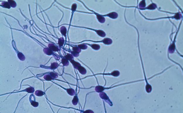 Espermatozoides teñidos visto a gran aumento.
