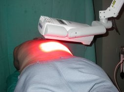 La terapia fotodinámica es muy eficaz para ciertas lesiones cutáneas. / SUR/