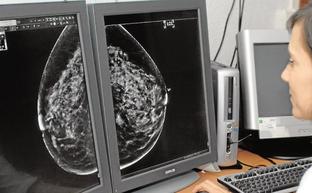 Una especialista en radiología mira una mamografía para hacer una valoración del caso./SUR