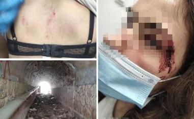 «¿Por favor, me puede usted ayudar? Mi novio me ha dado una paliza»